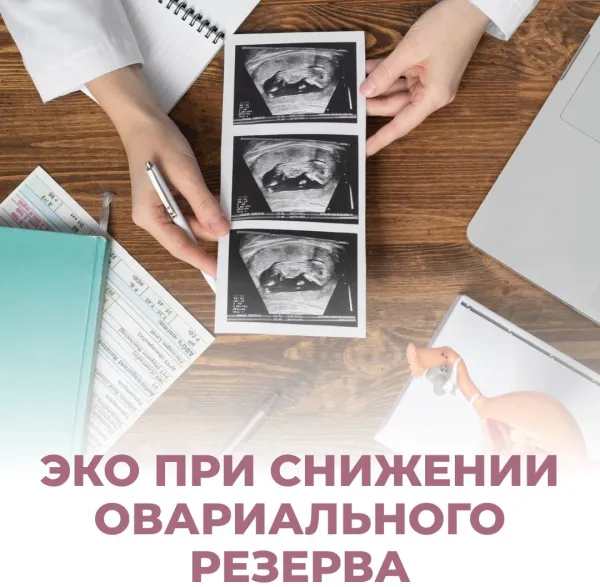 Если ваш диагноз -- преждевременное истощение яичников: варианты действий